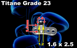 lot de 5 ancrages dermiques en titane grade 23- filetage interne 1.2 mm - calibre externe 1.6 mm - hauteur : 2.5 mm